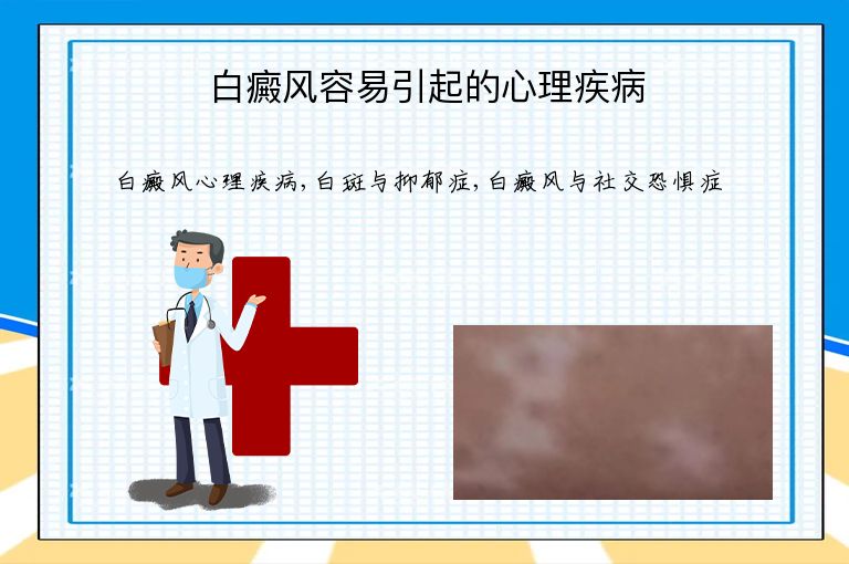 https://www.bdfsjzyy.com/d/file/p/ce4dbfc8ee3bdb65d70929eaee9e5bc8.jpeg