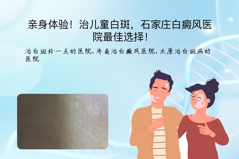 亲身体验!治儿童白斑,石家庄白癜风医院最佳选择!”