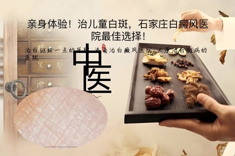 亲身体验!治儿童白斑,石家庄白癜风医院最佳选择!”