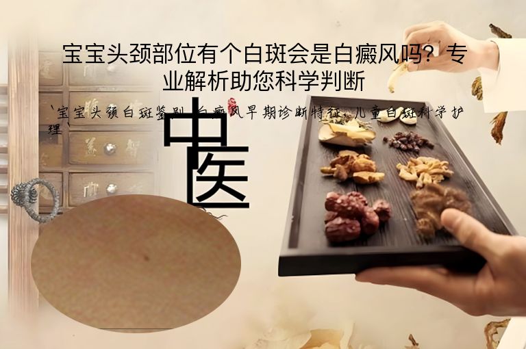 宝宝头颈部位有个白斑会是白癜风吗？专业解析助您科学判断”