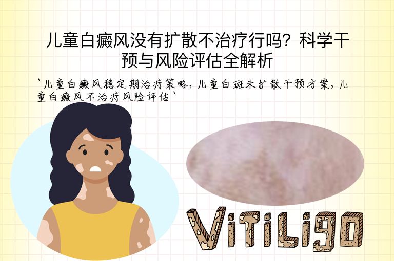 儿童白癜风没有扩散不治疗行吗？科学干预与风险评估全解析