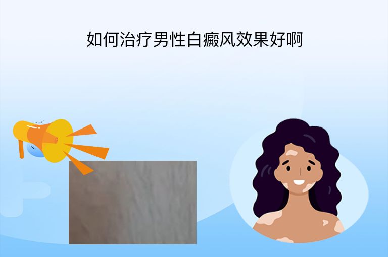 如何治疗男性白癜风效果好啊”