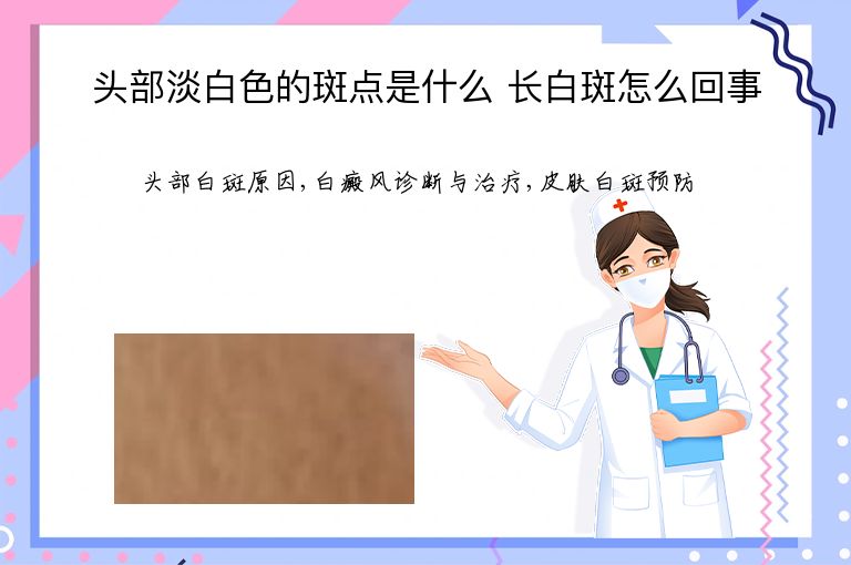 头部淡白色的斑点是什么 长白斑怎么回事”