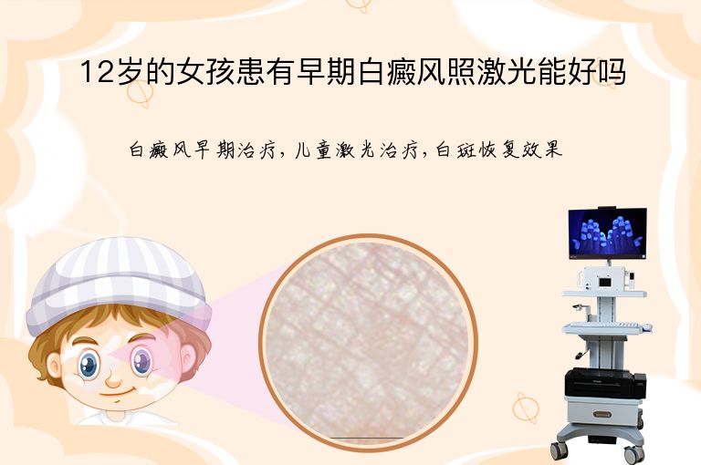 12岁的女孩患有早期白癜风照激光能好吗”
