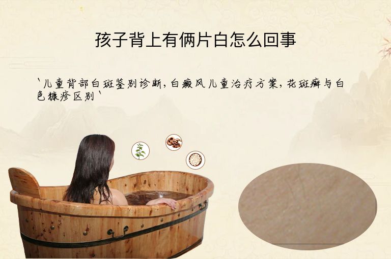 孩子背上有俩片白怎么回事