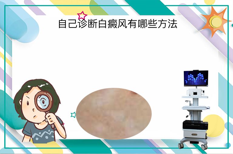 自己诊断白癜风有哪些方法”
