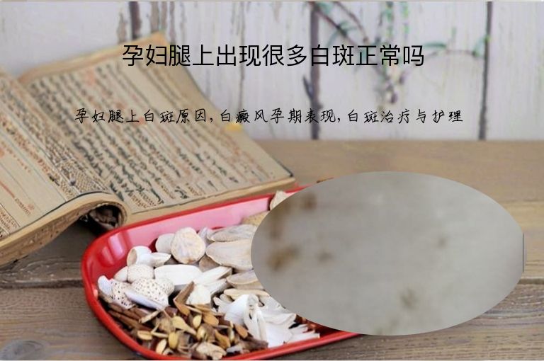 孕妇腿上出现很多白斑正常吗”