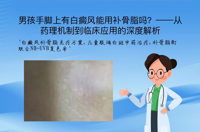 男孩手脚上有白癜风能用补骨脂吗？——从药理机制到临床应用的深度解析