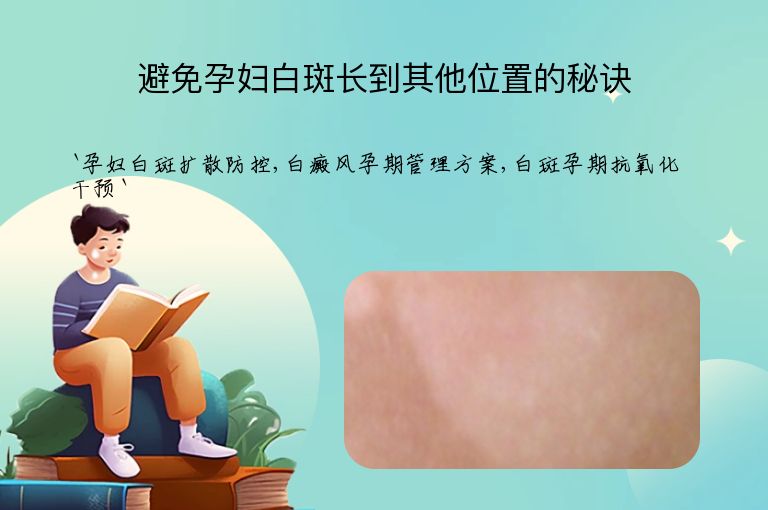 避免孕妇白斑长到其他位置的秘诀