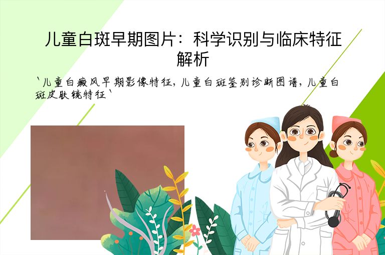 儿童白斑早期图片：科学识别与临床特征解析