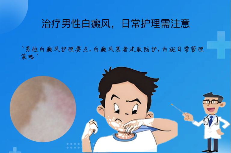 治疗男性白癜风，日常护理需注意