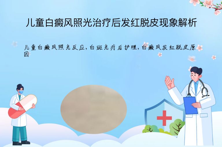 儿童白癜风照光治疗后发红脱皮现象解析”