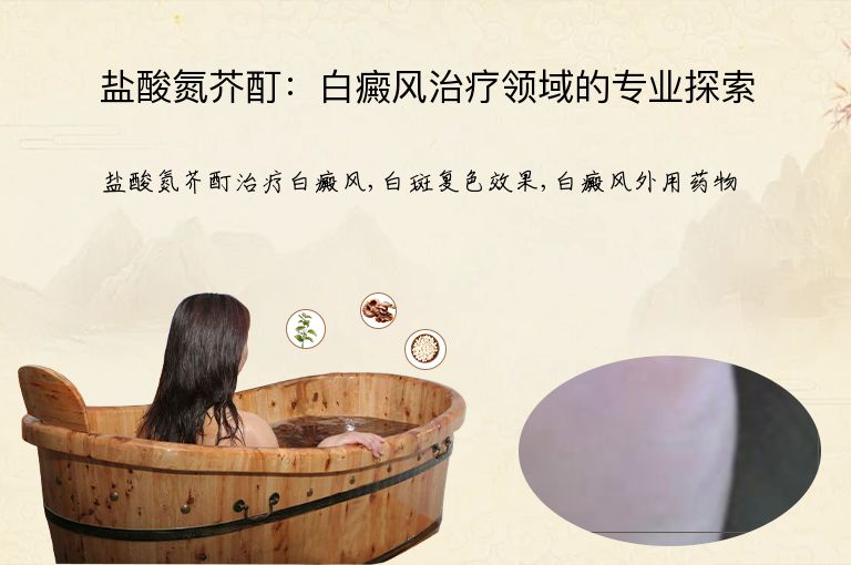 盐酸氮芥酊:白癜风治疗领域的专业探索”