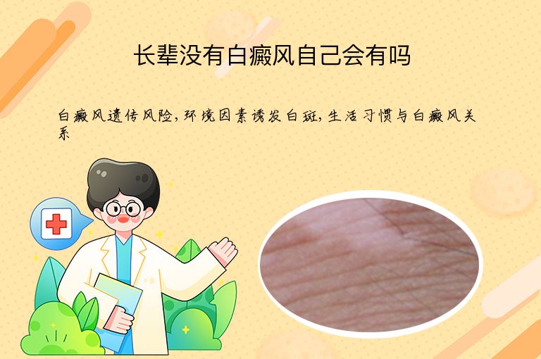 长辈没有白癜风自己会有吗”