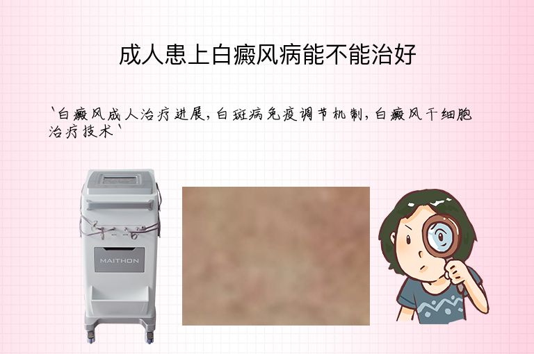 https://www.bdfsjzyy.com/d/file/p/8d164e655349c9914917ae971bd2f229.jpeg