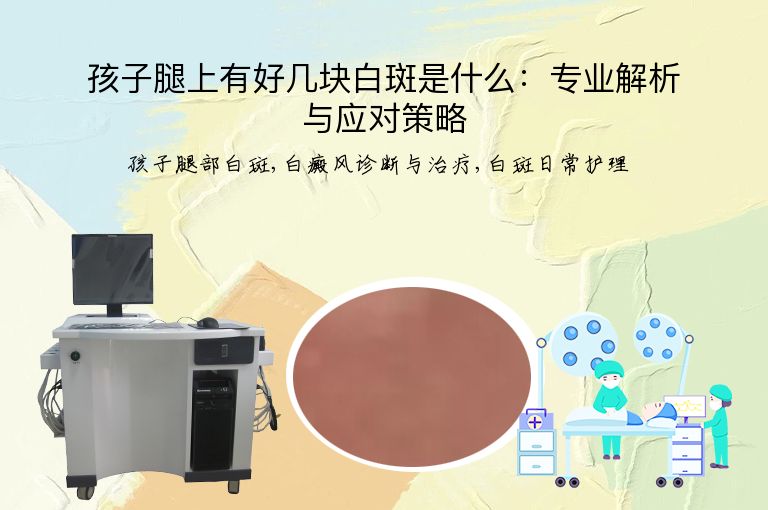 孩子腿上有好几块白斑是什么:专业解析与应对策略”