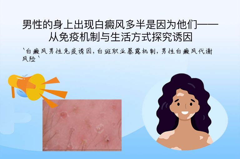 男性的身上出现白癜风多半是因为他们——从免疫机制与生活方式探究诱因