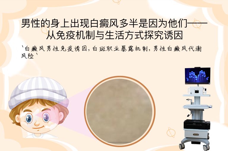 男性的身上出现白癜风多半是因为他们——从免疫机制与生活方式探究诱因