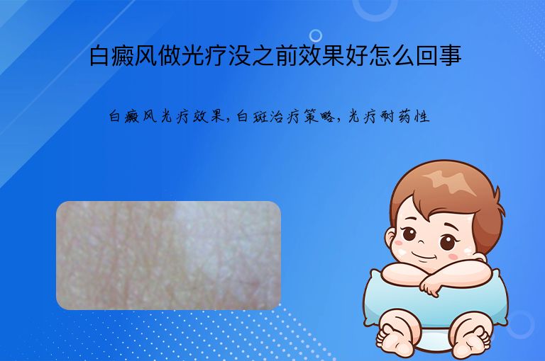 白癜风做光疗没之前效果好怎么回事”