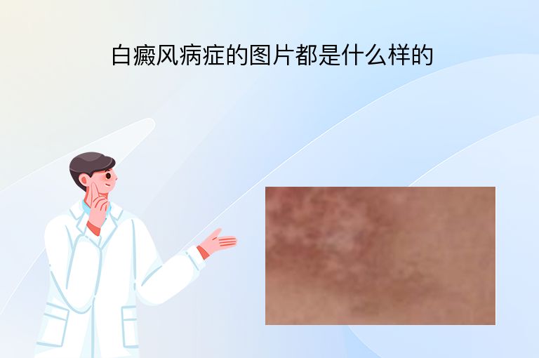 https://www.bdfsjzyy.com/d/file/p/c148352d773510b3cb5b93022d4af870.jpeg