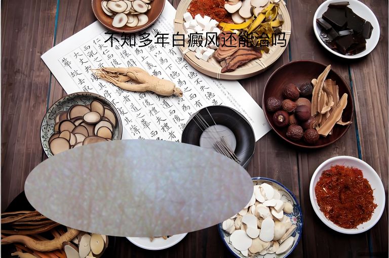 不知多年白癜风还能治吗”
