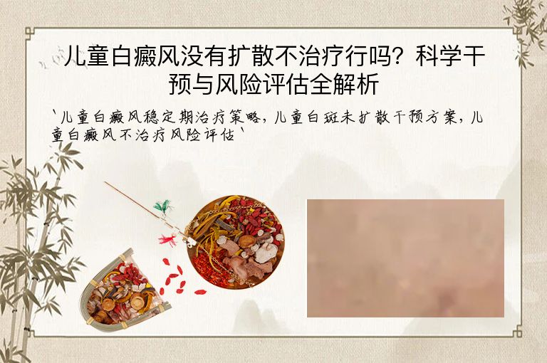 儿童白癜风没有扩散不治疗行吗?科学干预与风险评估全解析