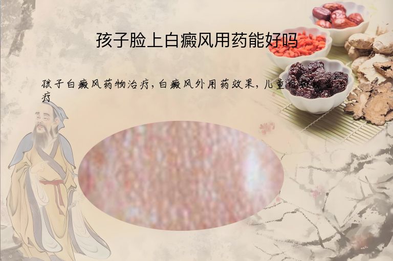 孩子脸上白癜风用药能好吗”