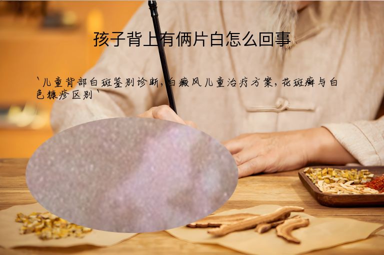 孩子背上有俩片白怎么回事