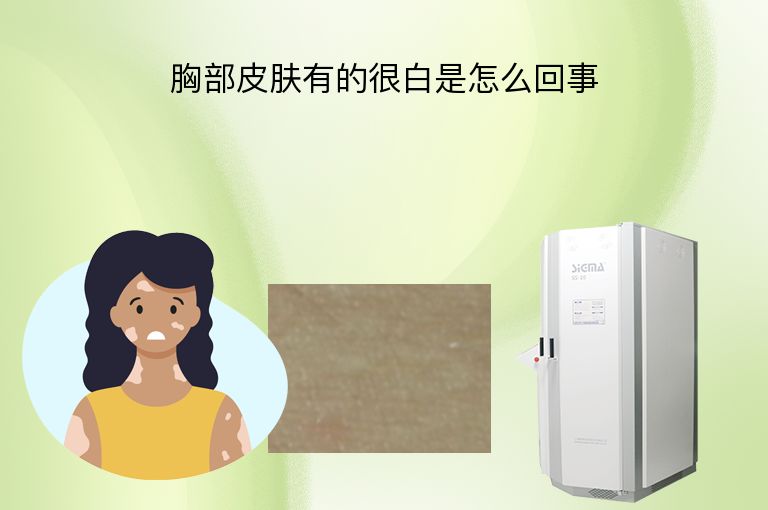 https://www.bdfsjzyy.com/d/file/p/741b9a8f2b0bf05f291e62e2621870aa.jpeg