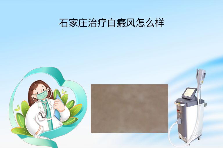 石家庄治疗白癜风怎么样”