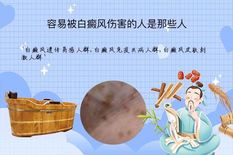 https://www.bdfsjzyy.com/d/file/p/2a3a51f87b04f6b1dcf42f60e9078f1e.jpeg