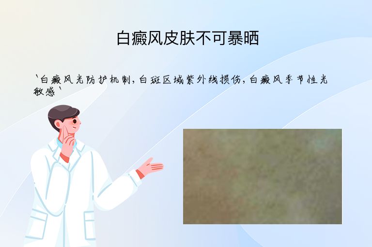 白癜风皮肤不可暴晒