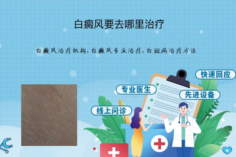 白癜风要去哪里治疗”