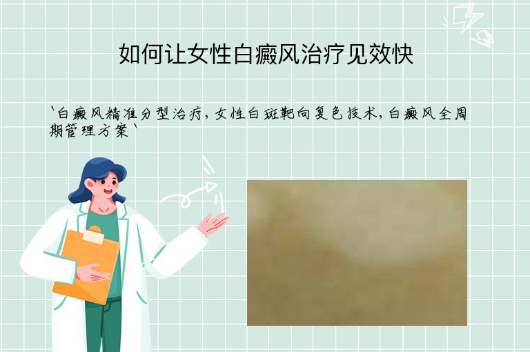 如何让女性白癜风治疗见效快”