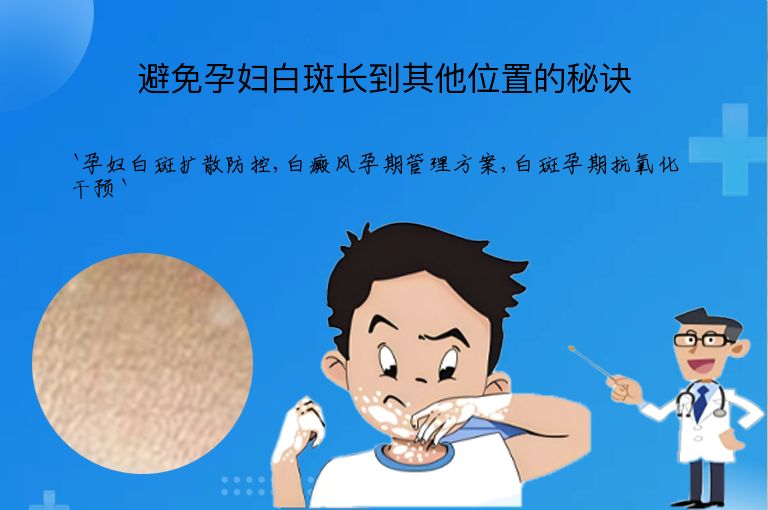 避免孕妇白斑长到其他位置的秘诀
