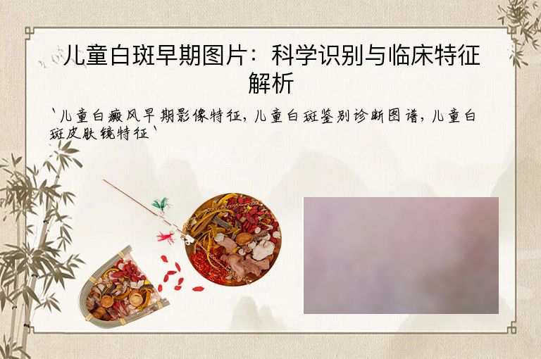 儿童白斑早期图片：科学识别与临床特征解析