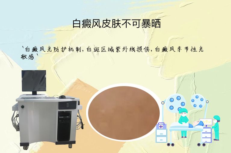 白癜风皮肤不可暴晒