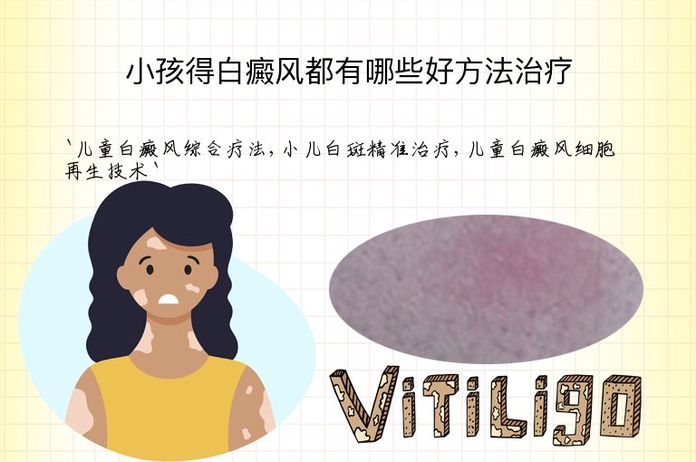 小孩得白癜风都有哪些好方法治疗”