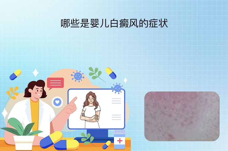 https://www.bdfsjzyy.com/d/file/p/122ff7d972c42d099f8209cd4ddfe25c.jpeg