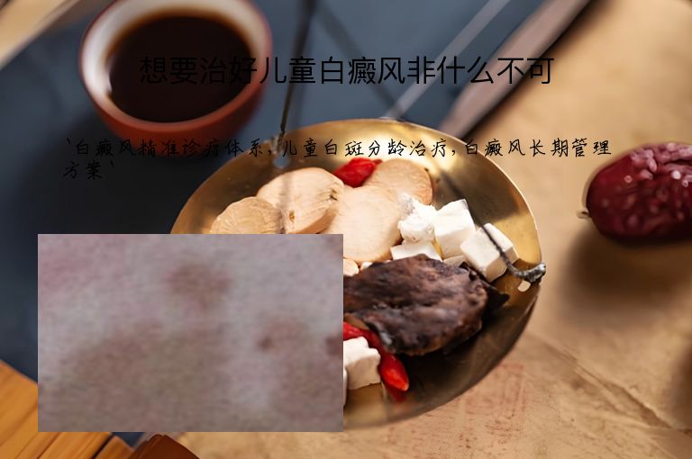 想要治好儿童白癜风非什么不可”