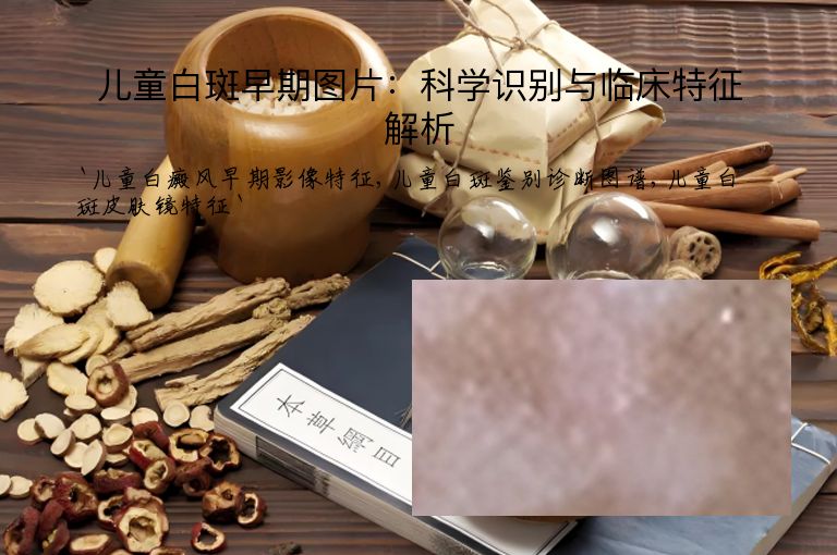 儿童白斑早期图片：科学识别与临床特征解析”