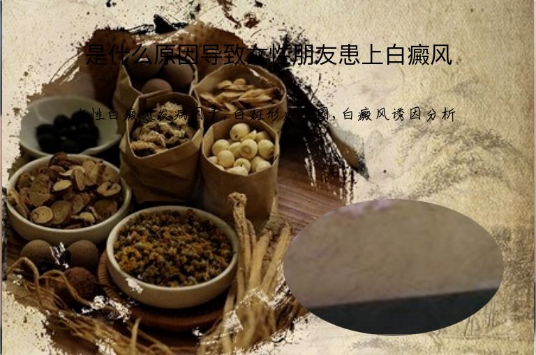 是什么原因导致女性朋友患上白癜风”