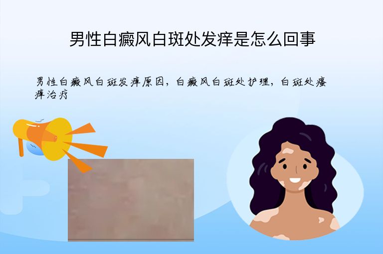 男性白癜风白斑处发痒是怎么回事”