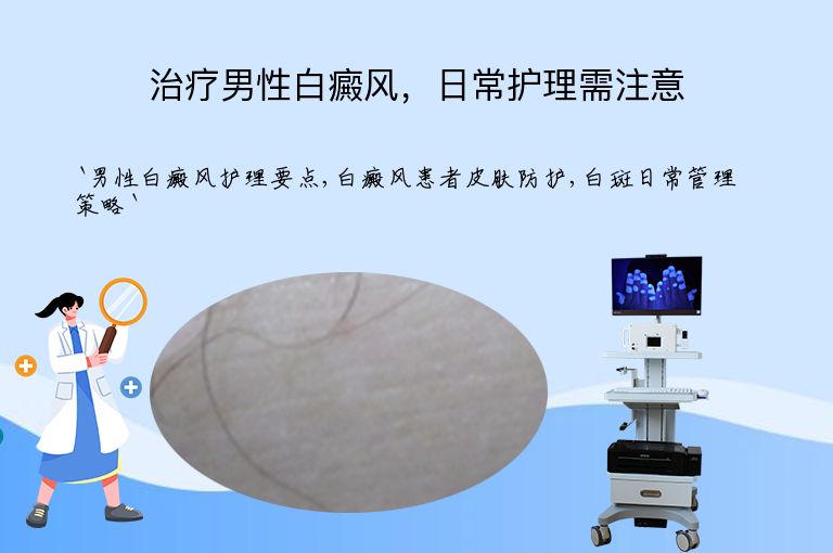 治疗男性白癜风,日常护理需注意