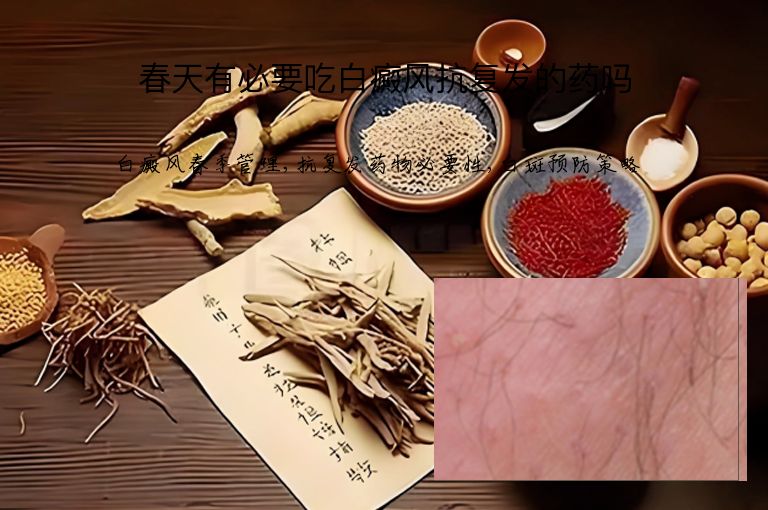 春天有必要吃白癜风抗复发的药吗”