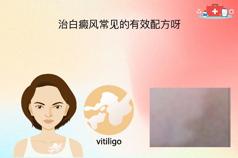 治白癜风常见的有效配方呀”