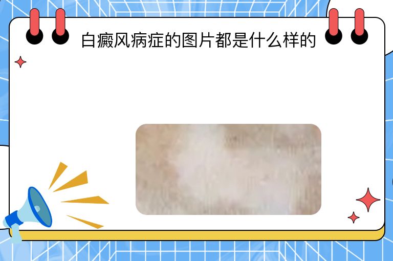https://www.bdfsjzyy.com/d/file/p/4348dabd49995bea88d05b704be8dcb5.jpeg
