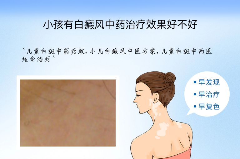 小孩有白癜风中药治疗效果好不好”