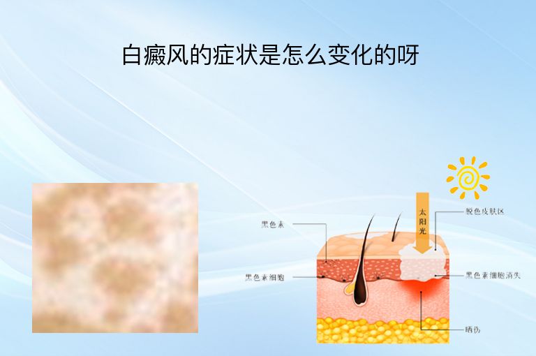 https://www.bdfsjzyy.com/d/file/p/5494546e39bd5440f6f9325e6469269a.jpeg