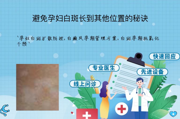 避免孕妇白斑长到其他位置的秘诀